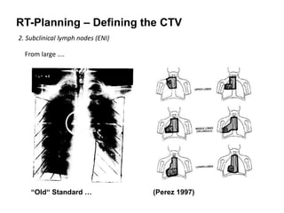 RT-Planning – Defining the CTV
2. Subclinical lymph nodes (ENI)
From large ....
“Old“ Standard … (Perez 1997)
 