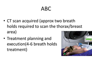 ABC
• CT scan acquired (approx two breath
holds required to scan the thorax/breast
area)
• Treatment planning and
execution(4-6 breath holds per
treatment)
 