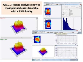 QA…… Fluence analyses showed
most planned cases treatable
with ≥ 95% fidelity
47
 