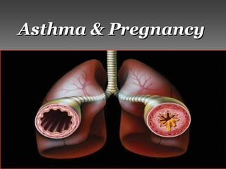 Asthma & PregnancyAsthma & Pregnancy
 