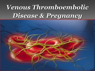 Venous ThromboembolicVenous Thromboembolic
Disease & PregnancyDisease & Pregnancy
 