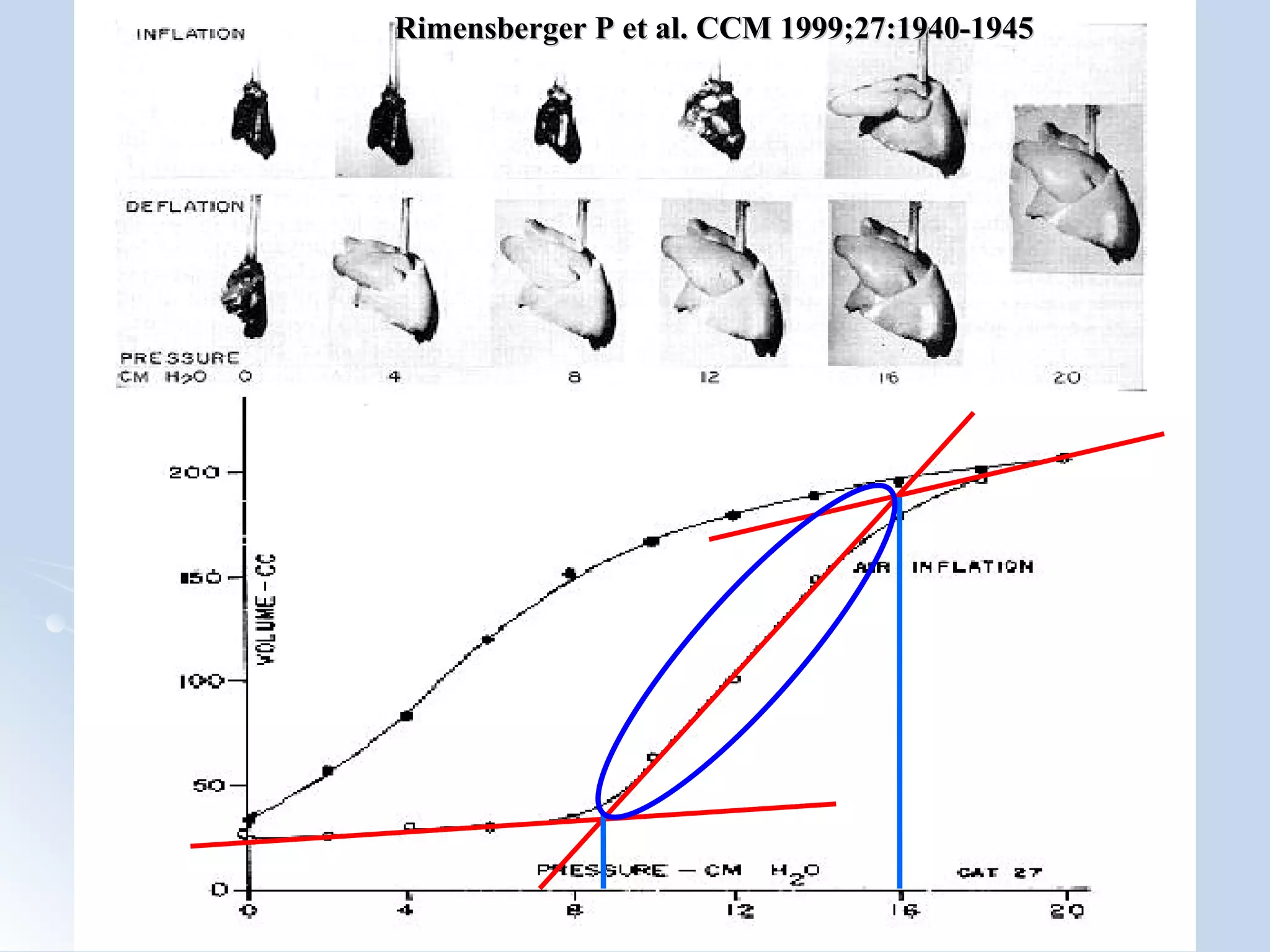 Rimensberger P et al. CCM 1999;27:1940-1945 
