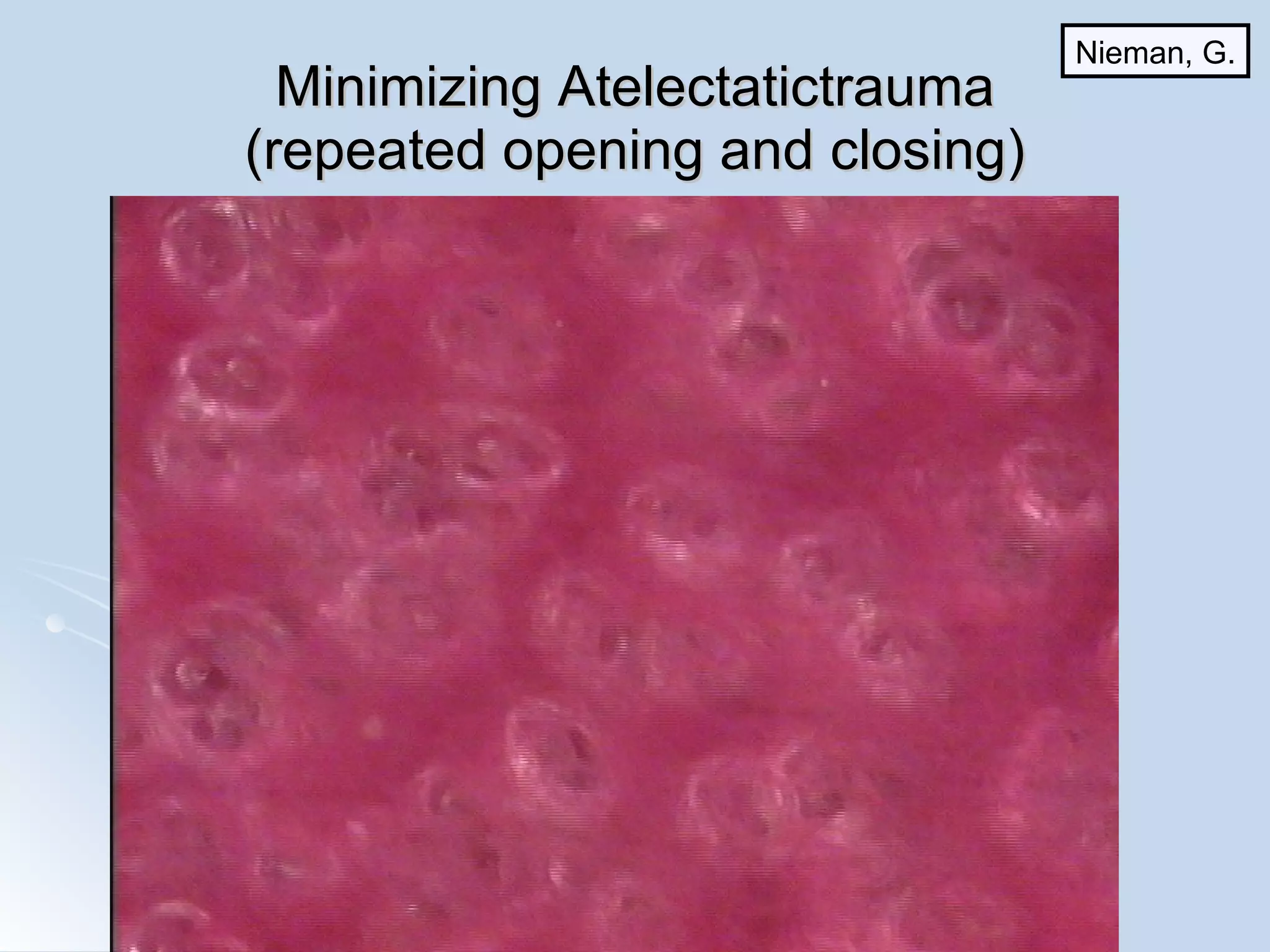 Minimizing Atelectatictrauma (repeated opening and closing) Nieman, G. 