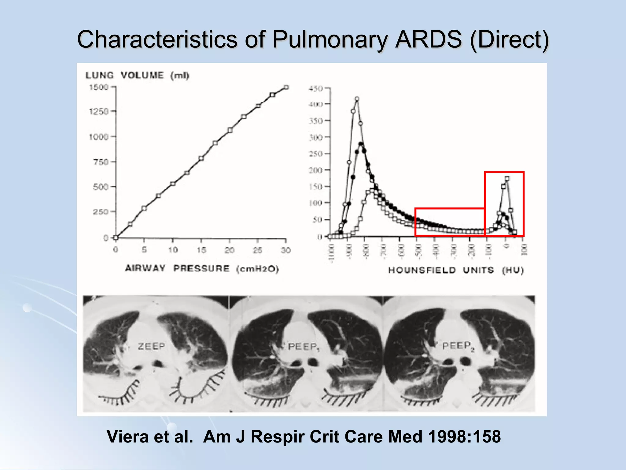 Characteristics of Pulmonary ARDS (Direct) Viera et al.  Am J Respir Crit Care Med 1998:158 