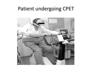 Patient undergoing CPET
 