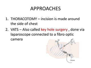 APPROACHES
1. THORACOTOMY – incision is made around
the side of chest
2. VATS – Also called key hole surgery , done via
laparoscope connected to a fibro optic
camera
 