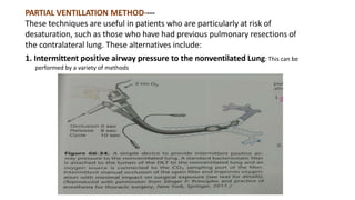 PARTIAL VENTILLATION METHOD----
These techniques are useful in patients who are particularly at risk of
desaturation, such as those who have had previous pulmonary resections of
the contralateral lung. These alternatives include:
1. Intermittent positive airway pressure to the nonventilated Lung: This can be
performed by a variety of methods
 