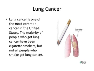 Lung CancerLung cancer is one of the most common cancer in the United States. The majority of people who get lung cancer have been cigarette smokers, but not all people who smoke get lung cancer.