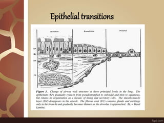 Epithelial transitions
 