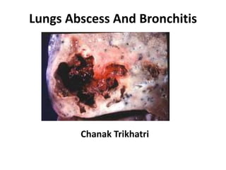Lungs Abscess And Bronchitis
Chanak Trikhatri
 