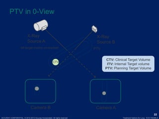 ACCURAY CONFIDENTIAL. © 2012-2013 Accuray Incorporated. All rights reserved. Treatment Options for Lung · ECK.700395.A
22
PTV in 0-View
PTVAll target motion un-tracked
CTV
Camera B Camera A
X-Ray
Source B
X-Ray
Source A
CTV: Clinical Target Volume
ITV: Internal Target volume
PTV: Planning Target Volume
 