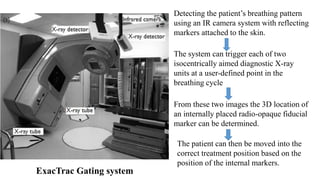 Detecting the patient’s breathing pattern
using an IR camera system with reflecting
markers attached to the skin.
The system can trigger each of two
isocentrically aimed diagnostic X-ray
units at a user-defined point in the
breathing cycle
From these two images the 3D location of
an internally placed radio-opaque fiducial
marker can be determined.
The patient can then be moved into the
correct treatment position based on the
position of the internal markers.
ExacTrac Gating system
 