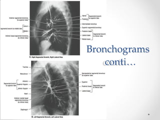 Lungs and clinical Correlations By Dr Rabia Inam Gandapore.pptx