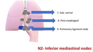 7. Sub- carinal
8. Para-esophageal
9. Pulmonary ligament node
N2- Inferior mediastinal nodes
 