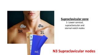 Supraclavicular zone
1- Lower cervical,
supraclavicular and
sternal notch nodes
1R 1L
T
E
IVC N3 Supraclavicular nodes
 