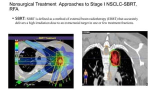 Thoracic Rfa Approach Management of ca lung - early stage -Dr Sumanth.pptx