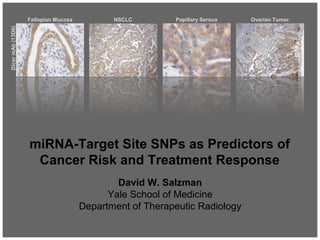 David W. Salzman
Yale School of Medicine
Department of Therapeutic Radiology
Fallopian Mucosa NSCLC Papillary Serous Ovarian Tumor
DicermAb(13D6)
miRNA-Target Site SNPs as Predictors of
Cancer Risk and Treatment Response
 