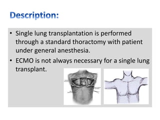 • Single lung transplantation is performed
through a standard thoractomy with patient
under general anesthesia.
• ECMO is not always necessary for a single lung
transplant.
 