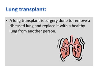 • A lung transplant is surgery done to remove a
diseased lung and replace it with a healthy
lung from another person.
 