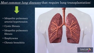 • Idiopathic pulmonary
arterial hypertension
• Cystic fibrosis
• Idiopathic pulmonary
fibrosis
• Emphysema
• Chronic bronchitis
Most common lung diseases that require lung transplantation:
 