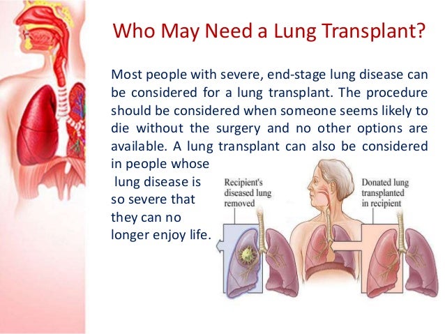 Lung Transplant Surgery in India
