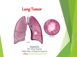 Lung Tumor
Prepared by
Mr.Abhay Rajpoot
HOD (Dep. of Medical Surgical)
abhayrajpoot5591@gmail.com
 