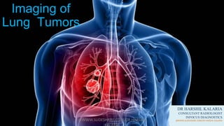 Imaging of
Lung Tumors
DR HARSHIL KALARIA
CONSULTANT RADIOLOGIST
INFOCUS DIAGNOSTICS
@WWW.SLIDESHARE.COM/DR HARSHIL KALARIA@WWW.SLIDESHARE.COM/DR HARSHIL
 