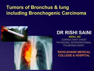 Tumors of Bronchus & lung
including Bronchogenic Carcinoma
DR RISHI SAINI
MBBS, MD
CONSULTANT CHEST
PHYSICIAN, INTERVENTIONAL
PULMONOLOGIST.
ROHILKHAND MEDICAL
COLLEGE & HOSPITAL
 