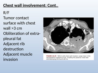 Comprehensive Radiological Overview of Lung Tumors and Thoracic ...