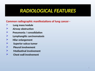 Comprehensive Radiological Overview of Lung Tumors and Thoracic ...