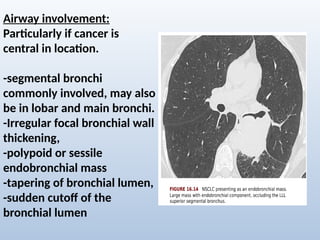 Comprehensive Radiological Overview of Lung Tumors and Thoracic ...