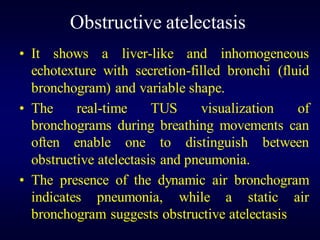 Lung Ultrasound | PDF