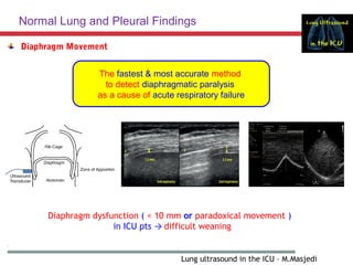Lung ultrasound in critical care 10.1.2019