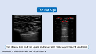 Lung Ultrasound in Cardiac Care | PPTX