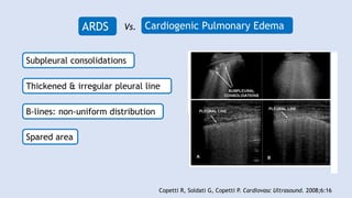 Lung Ultrasound in Cardiac Care | PPTX