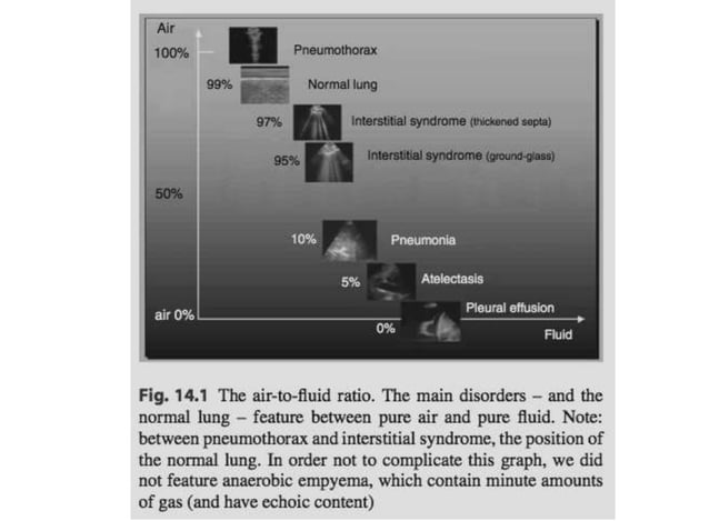 Principles of Lung Ultrasound | PPTX