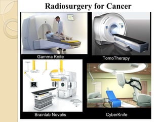 Radiosurgery for Cancer
 