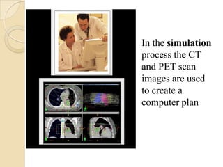In the simulation
process the CT
and PET scan
images are used
to create a
computer plan
 
