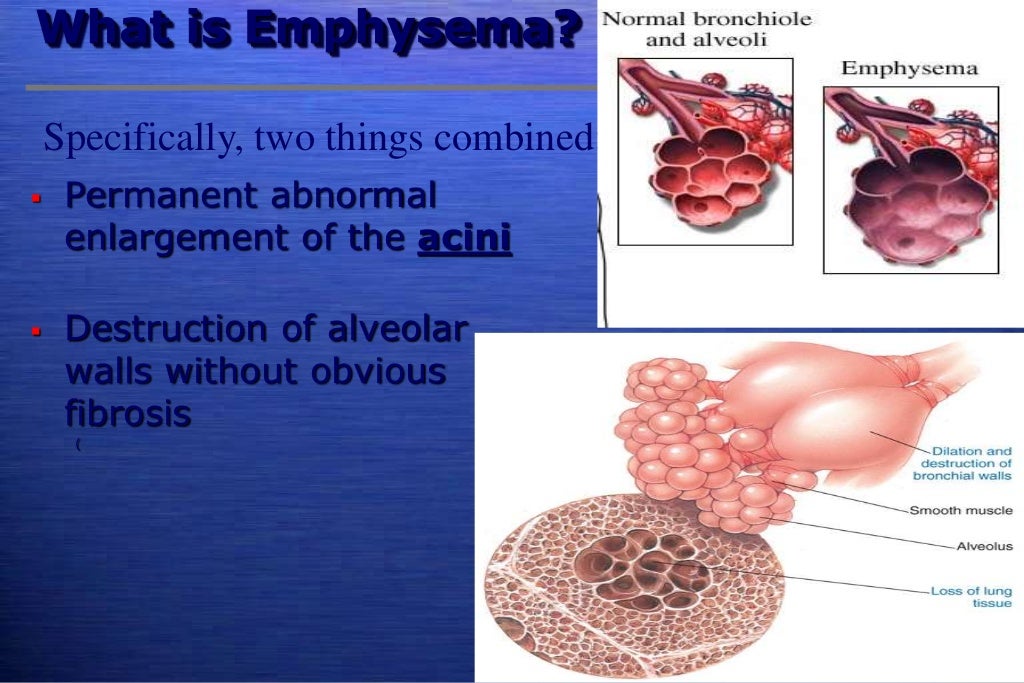 Lung volume reduction surgery