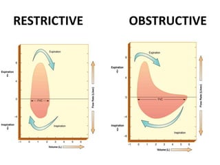 RESTRICTIVE OBSTRUCTIVE
 