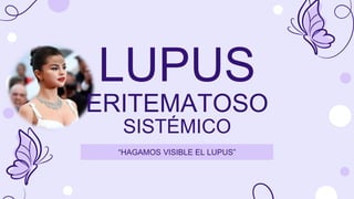 “HAGAMOS VISIBLE EL LUPUS”
LUPUS
ERITEMATOSO
SISTÉMICO
 