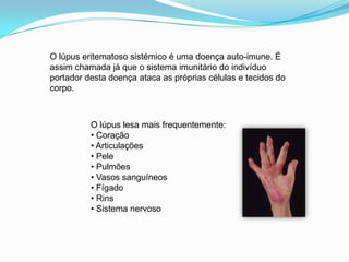O lúpus eritematoso sistémico é uma doença auto-imune. É assim chamada já que o sistema imunitário do indivíduo portador desta doença ataca as próprias células e tecidos do corpo.O lúpus lesa mais frequentemente: Coração 