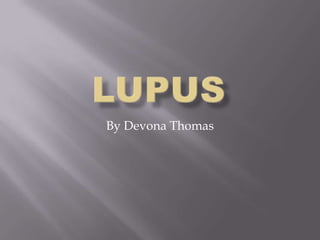 Lupus By Devona Thomas 
