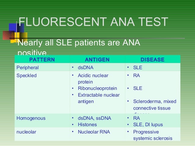 sle results oral test lupus erythematosus systemic sle results oral test lupus erythematosus systemic