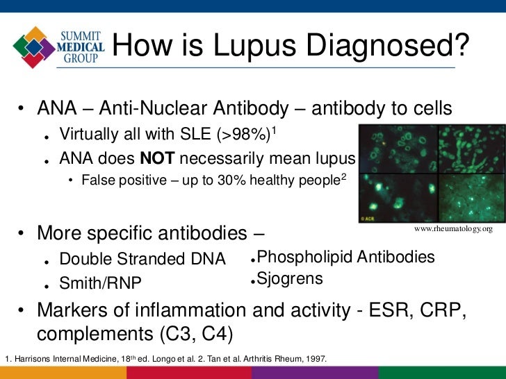 Lupus Lupus