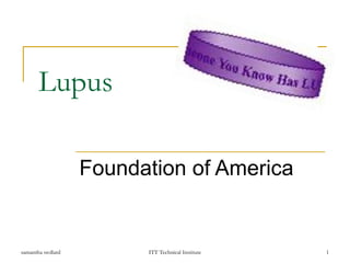 Lupus Foundation of America 