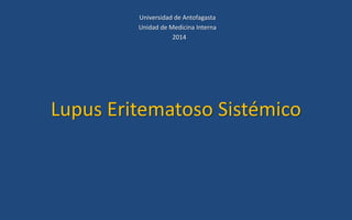 Lupus Eritematoso Sistémico
Universidad de Antofagasta
Unidad de Medicina Interna
2014
 