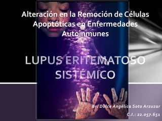 Alteración en la Remoción de Células 
Apoptóticas en Enfermedades 
Br. Dulce Angélica Soto Arzuzar 
C.I.: 22.057.651 
Autoinmunes 
 