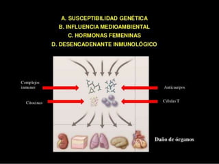 Lupus