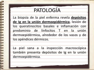 Lupus